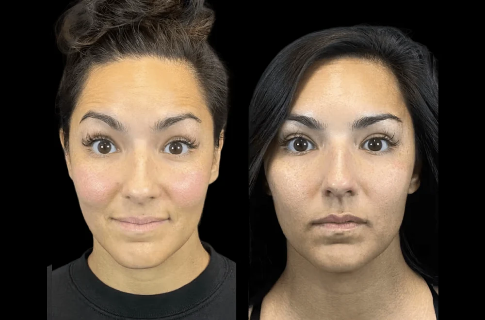 Best Aesthetic Clinic in Dubai