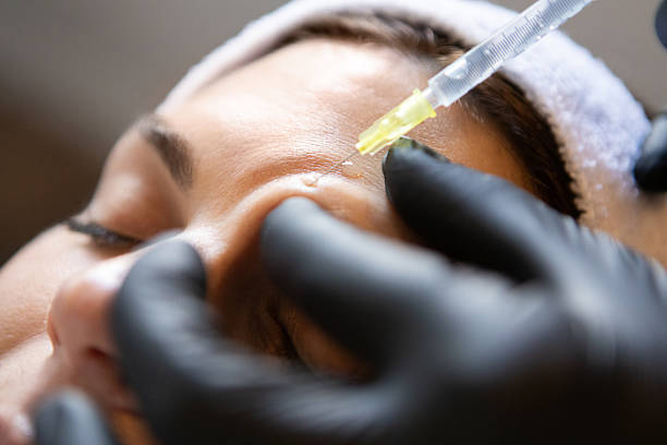 Botox injections in Dubai